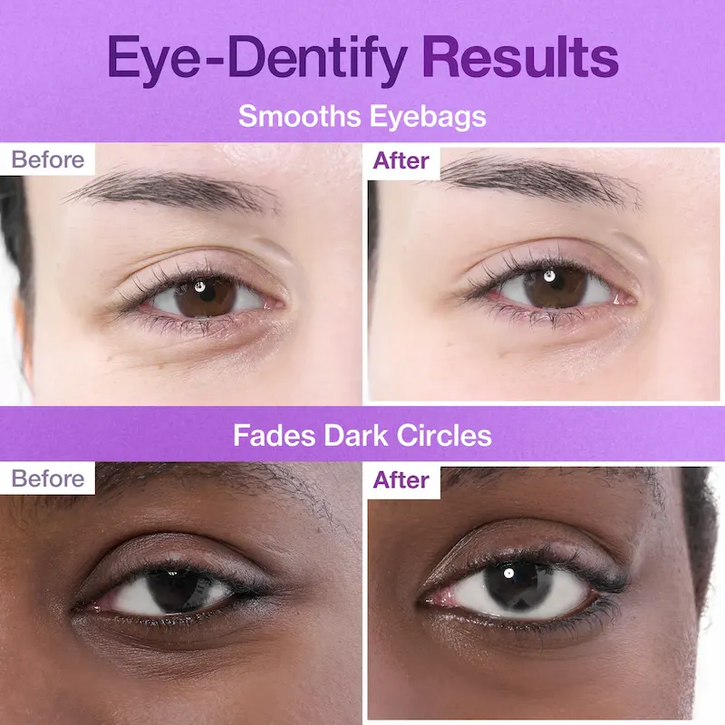 پچ زیر چشم NAD+ کلاژن شماره ۹ نامبوزین