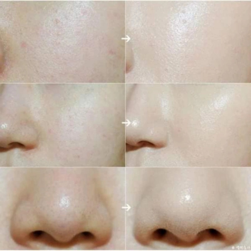 پرایمر مات کننده و کوچک کننده منافذ اینیسفری